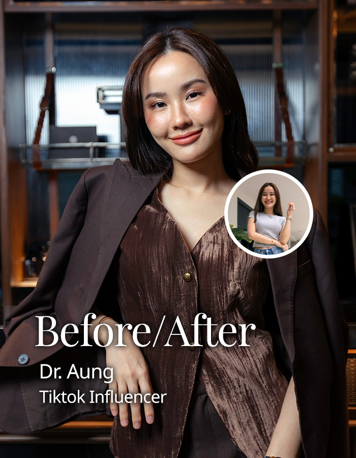 befor-after-draung