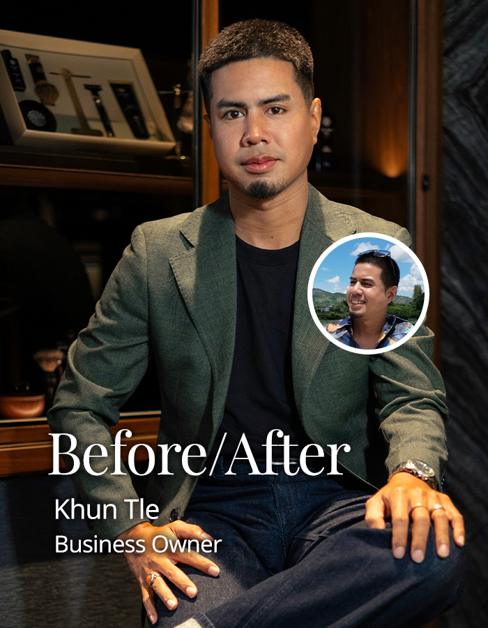 befor-after-khuntle