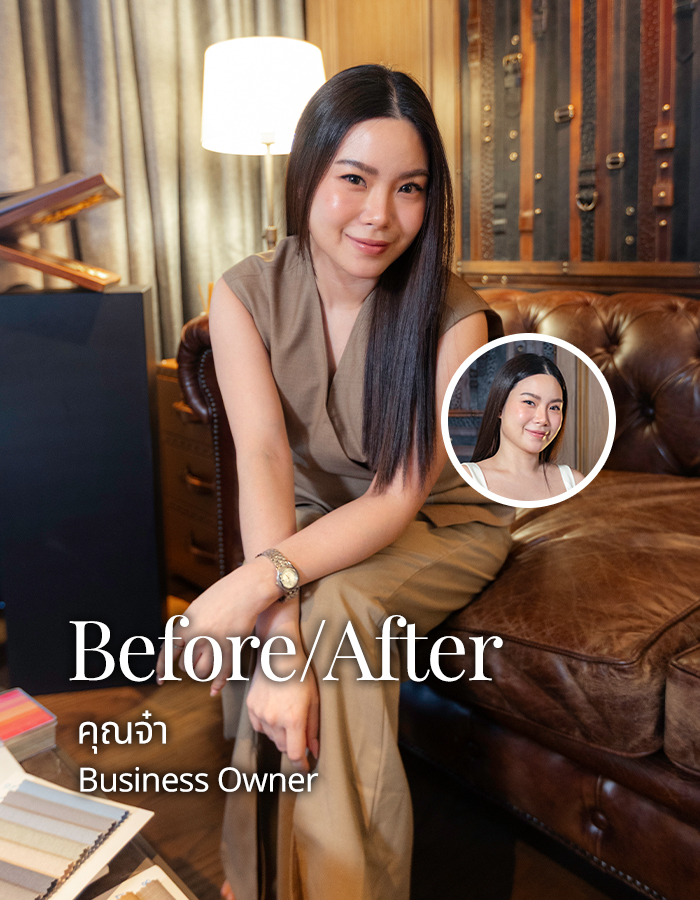 befor-after-คุณจ๋า