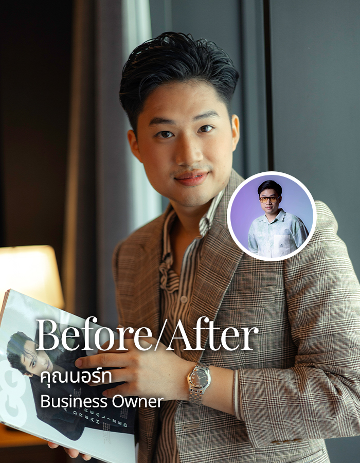 befor-after-คุณนอร์ท